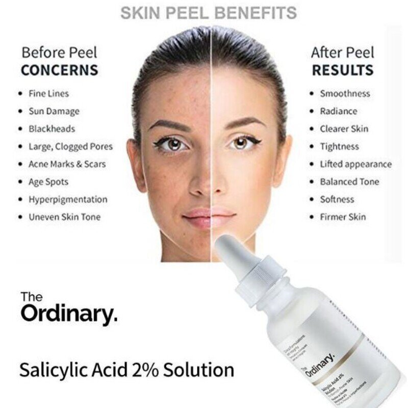 Mụn Li Ti Trên Mặt - Nỗi Ám Ảnh Không Của Riêng Ai 29 The Ordinary Salicylic Acid 2% Solution (Nguồn: Internet)