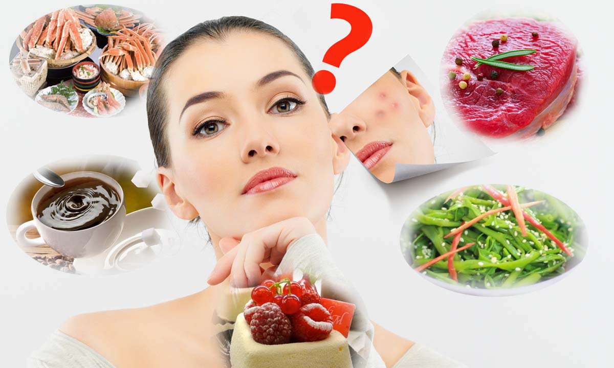 Mụn Li Ti Trên Mặt - Nỗi Ám Ảnh Không Của Riêng Ai 22 Chế độ ăn uống ảnh hưởng quan trọng đến mụn li ti trên mặt (Nguồn: Internet)