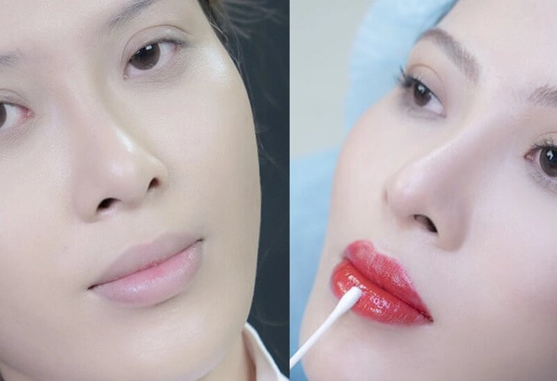 Phun Môi Màu Đỏ Đậm: Bí Quyết Sở Hữu Đôi Môi Quyến Rũ 15 Trước và sau khi phun môi tại Hamy Spa (Nguồn: Hamy Spa)
