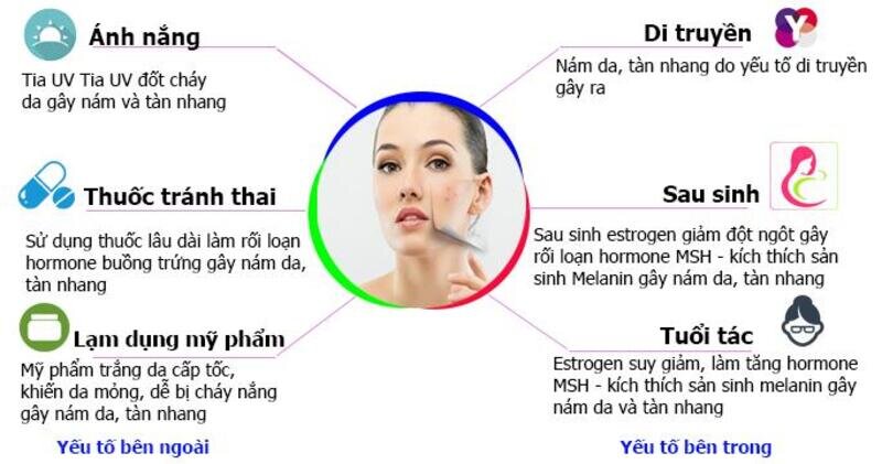 Nguyên nhân gây tăng sắc tố da (Nguồn: Internet)