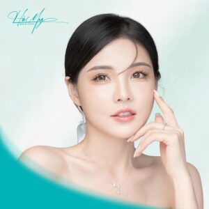 Tiêm meso giúp cho hai má tròn đẹp tự nhiên (Nguồn: Hà My Spa)