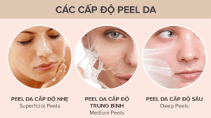 Peel da có tác dụng khác nhau tùy theo mức độ peel (Nguồn: Internet)