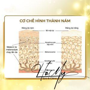 Cơ chế hình thành nám (Nguồn: Internet)