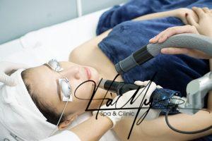 Trị nám bằng Laser PicoSure công nghệ điều trị nám mới nhất (Nguồn: Internet)
