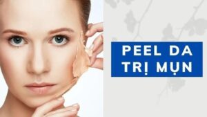 Peel da có thể giúp trị mụn trứng cá (Nguồn: Internet)