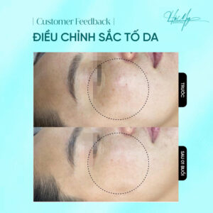 Feedback điều chỉnh sắc tố da tại Hamy Spa (Nguồn: Hamy Spa)